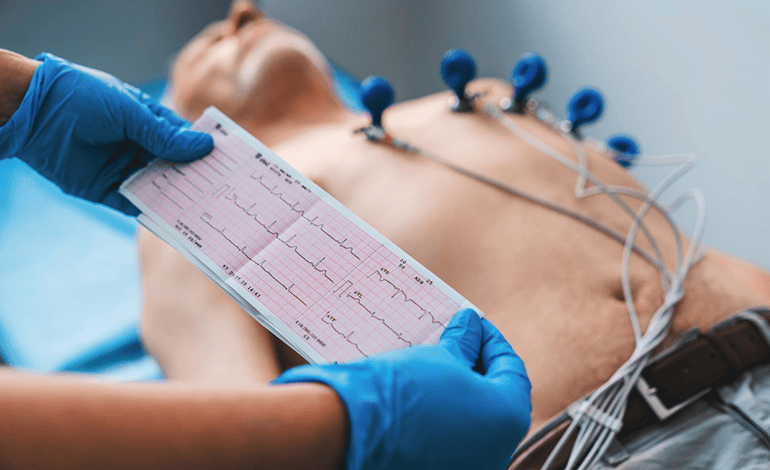 Electrocardiograma en adultos