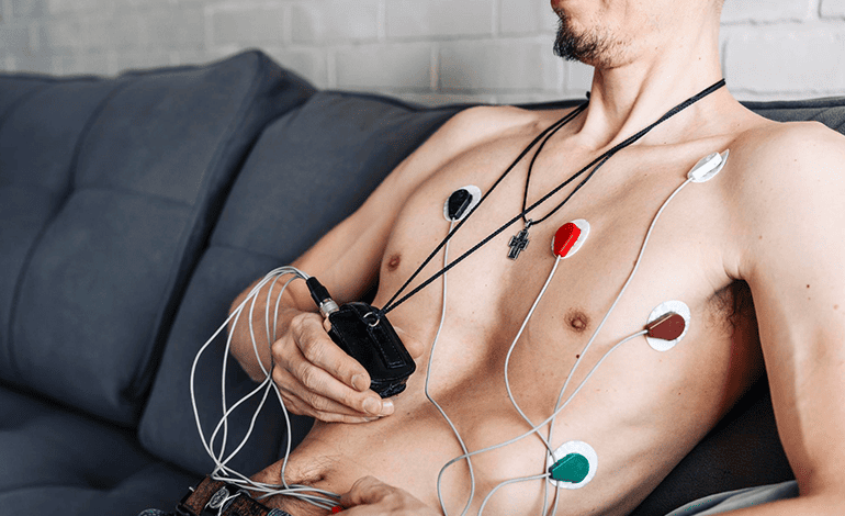 Holter del ritmo de 24 y 48 horas